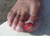 Dustin Toenail 02.jpg (54520 bytes)